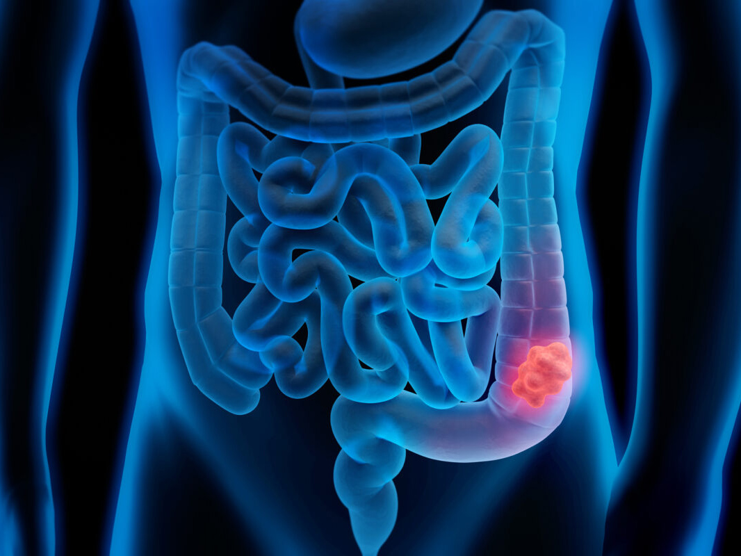xray view of man's intestinal system